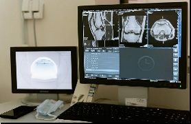 MRI of Leg on Computer