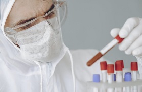 Person examining a test tube from a group of test tubes.